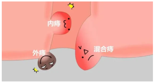 “微痛”体验(图8)