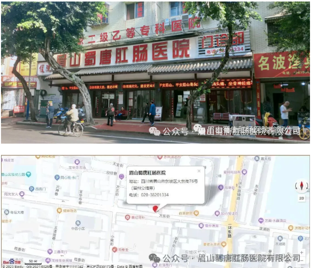 肛肠手术后多久能开车?术后恢复期这些事不能做(图9) 肛肠手术后多久能开车?术后恢复期这些事不能做(图9)